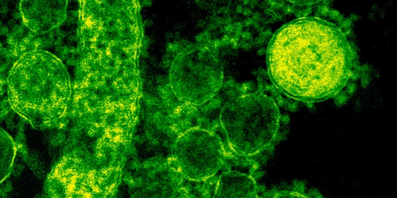 Madagascar Covid-19 : Une évolution inquiétante pour Madagascar